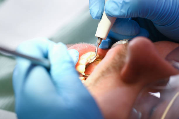 Best Emergency Care for Gum Disease in Aurora, IN